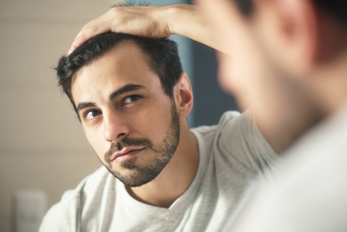 A handsome man inspects his scalp after using hair fibers while looking at the mirror. Concept of hair loss, balding men, hair transplant surgery, hair loss concealers.